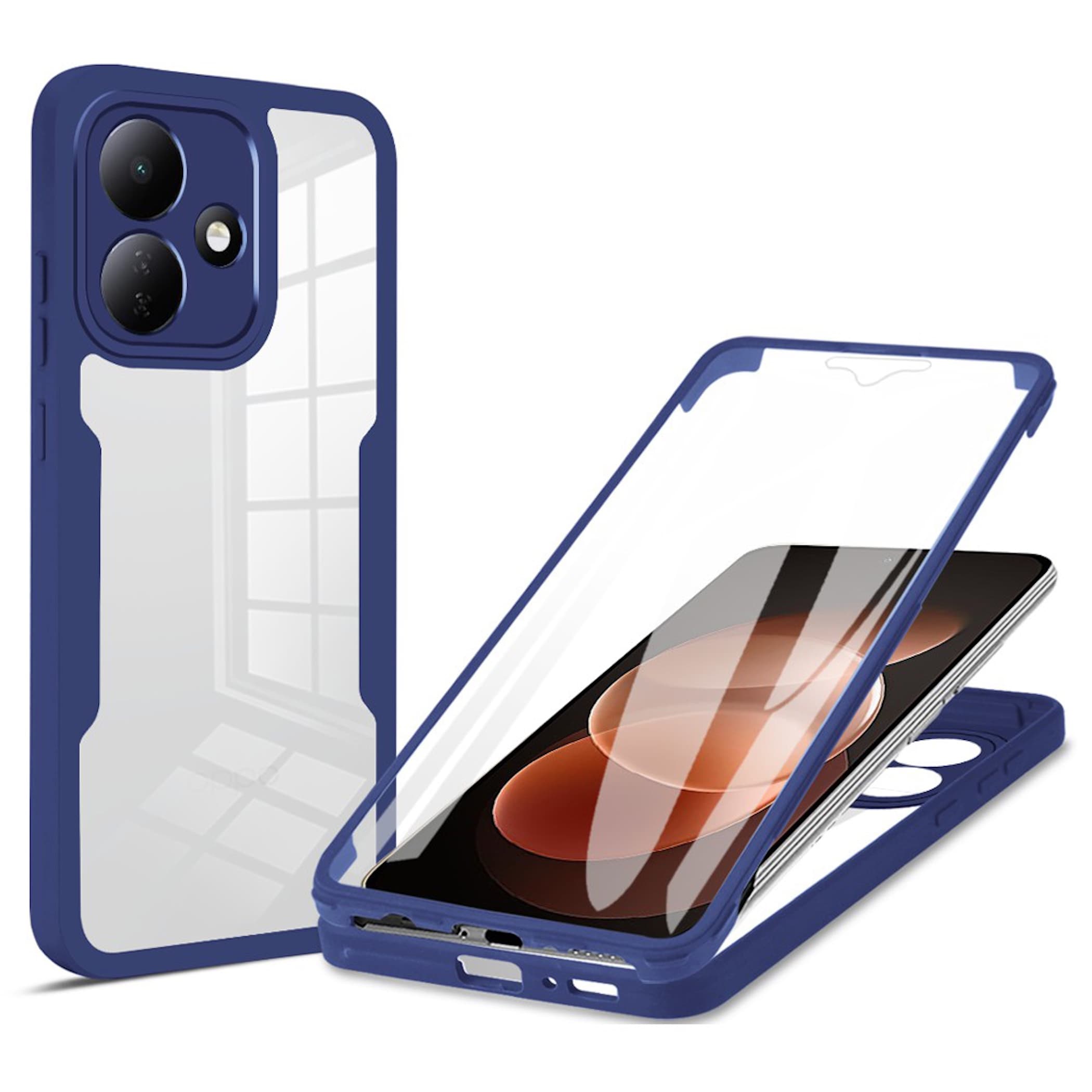 360 Grad Handyh&uuml;lle f&uuml;r Xiaomi Redmi Note 17 Pro 5G Display Folie & Kameraschutz 